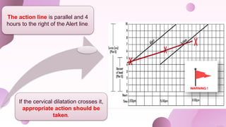 The action line is parallel and 4
hours to the right of the Alert line.
If the cervical dilatation crosses it,
appropriate action should be
taken.
WARNING !
 