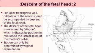 2
:
Descent of the fetal head
:
• For labor to progress well,
dilatation of the cervix should
be accompanied by descent
of the fetal head.
• The descent of the fetal head
is measured by ‘’station’’
which indicates its position in
relation to the ischial spine of
the mother’s pelvis.
• Station can only be
determined by vaginal
examination
 