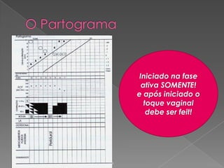 Iniciado na fase
ativa SOMENTE!
e após iniciado o
toque vaginal
debe ser feit!

Junho 2008/FEBRASGO

 