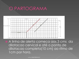 

A linha de alerta comeca aos 3 cms da
dilatacao cervical e até o ponto de
dilatacao completa(10 cm) ao ritmo de
1cm por hora.
Junho 2008/FEBRASGO

 