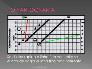 

Se dilatar rapido a linha fica vertical e se
dilatar de vagar a linha fica mais horizontal
Junho 2008/FEBRASGO

 
