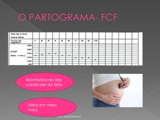 Monitorizacao das
condicoes do feto.

Meia em meia
hora.
Junho 2008/FEBRASGO

 