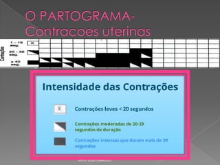 

As contracoes uterinas podem ser
registradas a cada 30 min

Junho 2008/FEBRASGO

 