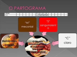 “M”
meconial

“S”
sanguinolent
o

“I”

Membranas
intactas

“C”
O líquido
amniótico fetal
é observado
em cada
toque vaginal.
Junho 2008/FEBRASGO

claro

 