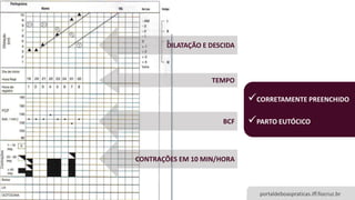 PREENCHIMENTO DE PARTOGRAMA
portaldeboaspraticas.iff.fiocruz.br
CONTRAÇÕES EM 10 MIN/HORA
TEMPO
DILATAÇÃO E DESCIDA
BCF
CORRETAMENTE PREENCHIDO
PARTO EUTÓCICO
 