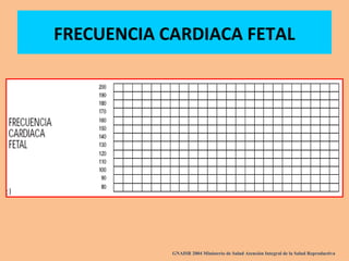 FRECUENCIA CARDIACA FETAL
GNAISR 2004 Ministerio de Salud Atención Integral de la Salud Reproductiva
 