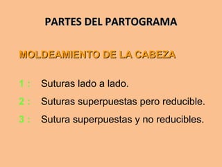 PARTES DEL PARTOGRAMAPARTES DEL PARTOGRAMA
MOLDEAMIENTO DE LA CABEZAMOLDEAMIENTO DE LA CABEZA
1 : Suturas lado a lado.
2 : Suturas superpuestas pero reducible.
3 : Sutura superpuestas y no reducibles.
 