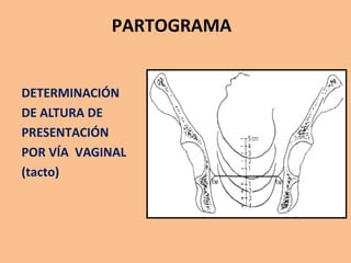 PARTOGRAMA
DETERMINACIÓN
DE ALTURA DE
PRESENTACIÓN
POR VÍA VAGINAL
(tacto)
 