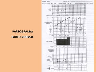PARTOGRAMA:PARTOGRAMA:
PARTO NORMALPARTO NORMAL
 