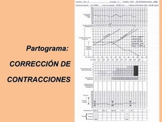 Partograma:Partograma:
CORRECCIÓN DECORRECCIÓN DE
CONTRACCIONESCONTRACCIONES
 