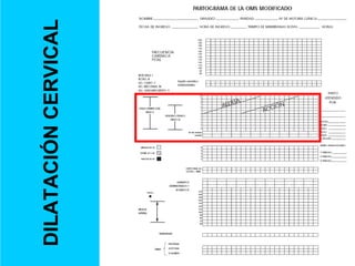 DILATACIÓN
CERVICAL
 