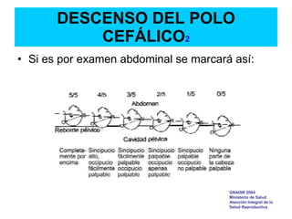 DESCENSO DEL POLO
CEFÁLICO2
• Si es por examen abdominal se marcará así:
GNAISR 2004
Ministerio de Salud
Atención Integral de la
Salud Reproductiva
 