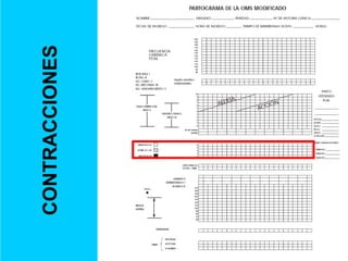 CONTRACCIONES
 