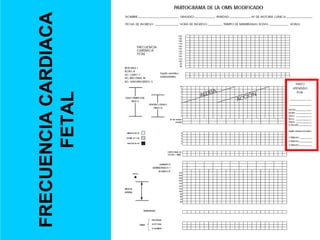 FRECUENCIA
CARDIACA
FETAL
 