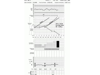 partogramaoms-091021232059-phpapp01.pdf