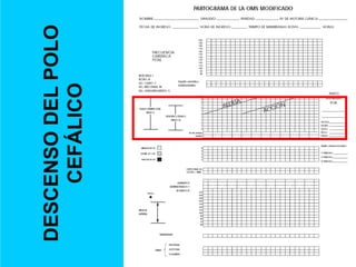 DESCENSO DEL POLO CEFÁLICO 