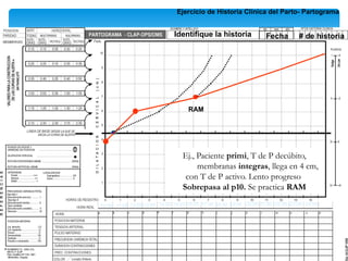 Ejercicio de Historia Clínica del Parto- Partograma
10:00 11:00 12:00 14:00 15:00 16:00 17:00 18:00 19:00
13:00
Ej., Paciente primi, T de P decúbito,
membranas integras, llega en 4 cm,
con T de P activo. Lento progreso
Sobrepasa al p10. Se practica RAM
Identifique la historia Fecha # de historia
RAM
22:00
21:00
20:00 23:00 24:00
 