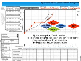Ejercicio de Historia Clínica del Parto- Partograma
10:00 11:00 12:00 14:00 15:00 16:00 17:00 18:00 19:00
13:00
Ej., Paciente primi, T de P decúbito,
membranas integras, llega en 4 cm, con T de P activo.
Progresa bien hasta 7 cm, se detiene
Sobrepasa al p10. se practica RAM
Identifique la historia Fecha # de historia
22:00
21:00
20:00 23:00 24:00
RAM
Actividad
uterina
Epidural
Evacuar
vejiga DCP
 