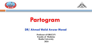 Partogram( Dr Ahmed Walid Anwar Morad) professor of Ob & Gyn, Benha ...