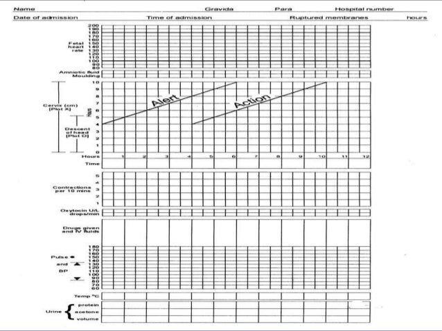 Partograph Chart Download