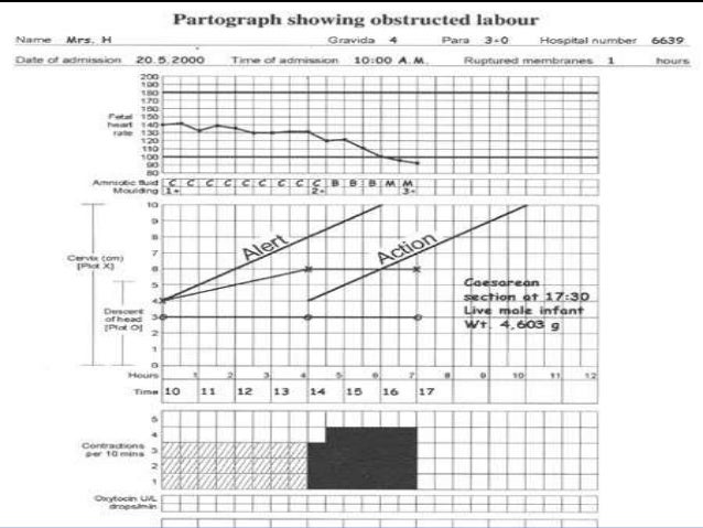 Partograph Chart Download