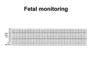 Fetal monitoringFetal monitoring
 