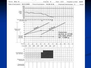 PARTOGRAPHHHHHHHHHHHHHHHHHHHHHHHHHHH.pptx