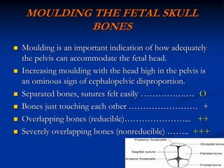 MOULDING THE FETAL SKULL
BONES
 Moulding is an important indication of how adequately
the pelvis can accommodate the fetal head.
 Increasing moulding with the head high in the pelvis is
an ominous sign of cephalopelvic disproportion.
 Separated bones, sutures felt easily …………….… O
 Bones just touching each other …………………… +
 Overlapping bones (reducible)…………………... ++
 Severely overlapping bones (nonreducible) …….. +++
 