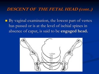 DESCENT OF THE FETAL HEAD (cont..)
 By vaginal examination, the lowest part of vertex
has passed or is at the level of ischial spines in
absence of caput, is said to be engaged head.
 
