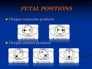 FETAL POSITIONS
 Occiput transverse positions
 Occiput anterior positions
 