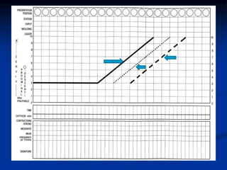 PARTOGRAPHHHHHHHHHHHHHHHHHHHHHHHHHHH.pptx