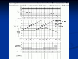 PARTOGRAPHHHHHHHHHHHHHHHHHHHHHHHHHHH.pptx