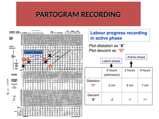 PARTOGRAPH... RECORDING AND PROCESS.ppt