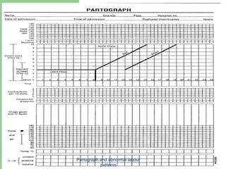Pathograph Graph PARTOGRAPH & ABNORMAL LABOUR PATTERNS-2021.ppt