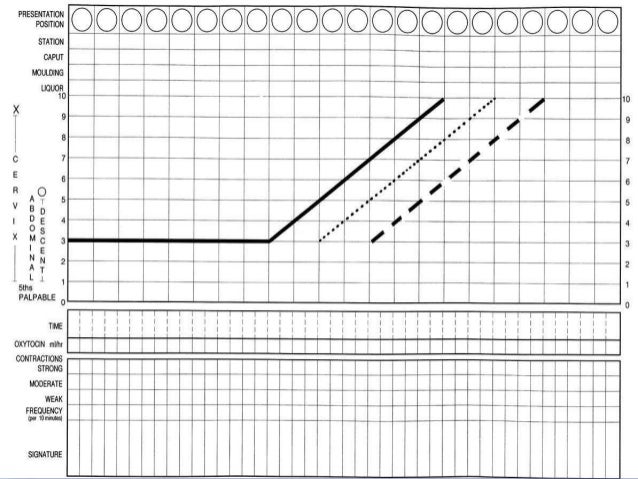 Labour Monitoring By Partograph By Dr Shashwat Jani