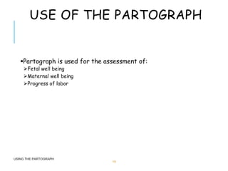 USE OF THE PARTOGRAPH
Partograph is used for the assessment of:
Fetal well being
Maternal well being
Progress of labor
USING THE PARTOGRAPH
19
 