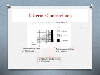 f.Uterine Contractions
5 strong contractions
in 10 minutes
2 weak contractions
in 10 minutes
3 moderate contractions
in 10 minutes
 