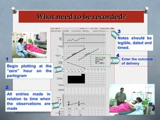 What need to be recorded?
Begin plotting at the
“zero” hour on the
partogram
Enter the outcome
of delivery
1
2
All entries made in
relation to time when
the observations are
made
3
Notes should be
legible, dated and
timed.
4
 