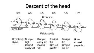 Descent of the head
 