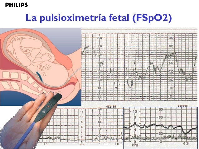 Imagen relacionada