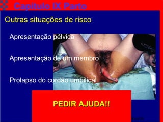TAT Cap. 9 Parto Iminente13
Capítulo IX Parto
Outras situações de risco
Apresentação pélvica
Apresentação de um membro
Prolapso do cordão umbilical
PEDIR AJUDA!!PEDIR AJUDA!!PEDIR AJUDA!!PEDIR AJUDA!!
 