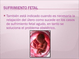 También está indicado cuando es necesaria la relajación del útero como sucede en los casos de sufrimiento fetal agudo, en tanto se soluciona el problema obstétrico. 