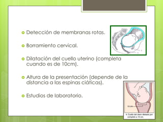  Detección de membranas rotas.
 Borramiento cervical.
 Dilatación del cuello uterino (completa
cuando es de 10cm).
 Altura de la presentación (depende de la
distancia a las espinas ciáticas).
 Estudios de laboratorio.
 