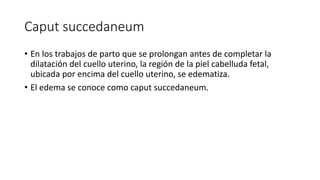 Caput succedaneum
• En los trabajos de parto que se prolongan antes de completar la
dilatación del cuello uterino, la región de la piel cabelluda fetal,
ubicada por encima del cuello uterino, se edematiza.
• El edema se conoce como caput succedaneum.
 