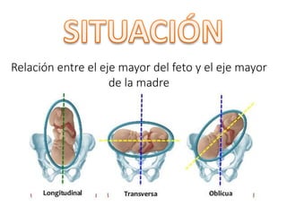Relación entre el eje mayor del feto y el eje mayor
de la madre
 