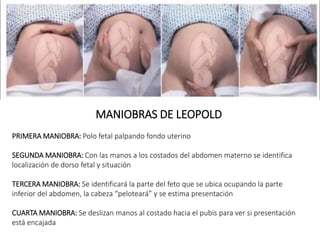 MANIOBRAS DE LEOPOLD
PRIMERA MANIOBRA: Polo fetal palpando fondo uterino
SEGUNDA MANIOBRA: Con las manos a los costados del abdomen materno se identifica
localización de dorso fetal y situación
TERCERA MANIOBRA: Se identificará la parte del feto que se ubica ocupando la parte
inferior del abdomen, la cabeza “peloteará” y se estima presentación
CUARTA MANIOBRA: Se deslizan manos al costado hacia el pubis para ver si presentación
está encajada
 