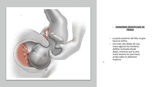 Universidad Nacional
Federico Villarreal
• MANIOBRA MODIFICADA DE
PRAGA
• La parte posterior del feto no gira
hacia la sínfisis.
• Con esto, dos dedos de una
mano agarran los hombros
delfeto reclinado desde
abajo, mientras que la otra
mano levanta los pies hacia
arriba sobre el abdomen
materno
•
 