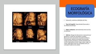 Universidad Nacional
Federico Villarreal
• Evaluación anatómica detallada del feto.
• Tipo de Ecografía: Especializada (Avanzada o
3er Nivel) de tamizaje.
• Edad a realizarse: Generalmente entre las 20 a
24 semanas
• Informa: Riesgo de alteraciones cromosómicas/
genéticas a través de marcadores, predice
Restricción del crecimiento intrauterino (RCIU) y
Preeclampsia, detecta anomalías estructurales,
riesgo de parto prematuro y brinda identificación
inicial de gestantes de alto riesgo y bajo riesgo con
mayor seguridad inicial de normalidad como un
concepto moderno de calidad.
ECOGRAFÍA
MORFOLÓGICA
 