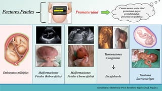 Factores Fetales Prematuridad
Cuanto menos sea la edad
gestacional mayor
probabilidad de
presentación podálica
Embarazos m...