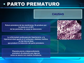 PARTO PREMATURO CAUSAS Rotura prematura de las membranas, Se produce por  lo menos en el 20% de las pacientes, la causa se desconoce. La enfermedad cardiovascular hipertensiva, y la hipertensividad aguda en el embarazo, diabetes mellitus,  en las tres se tiene que producir la inducción del parto prematuro. Placenta previa o desprendimiento  prematuro de placenta que algunas veces se asocia con madres fumadoras. 